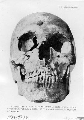 Calavera con dientes incrustados de jadeíta, de Chalchicomula, Puebla, México